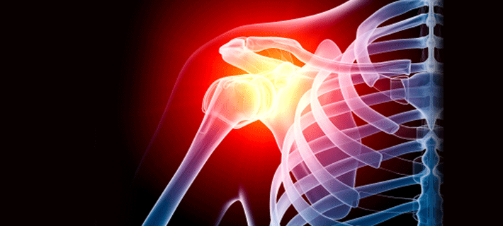 Боль в плече: вредные упражнения, которых стоит избегать